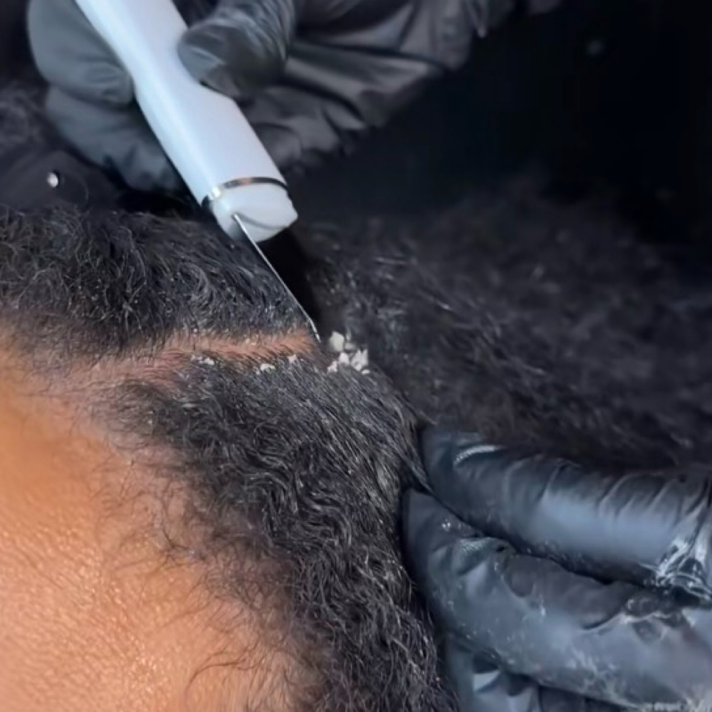 Scalp Treatment Add On at EnhancedbySue in Prairie Village, KS
