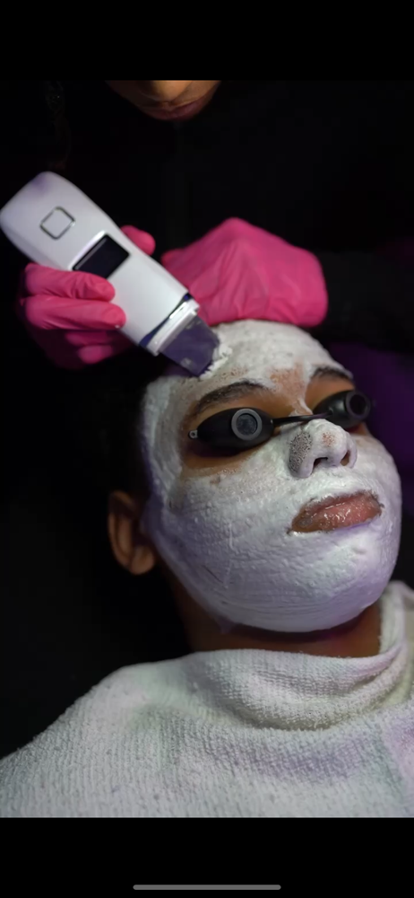 Facial Ultrasonic