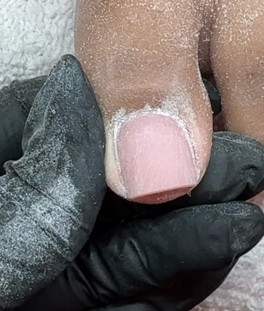 acrylic toesies