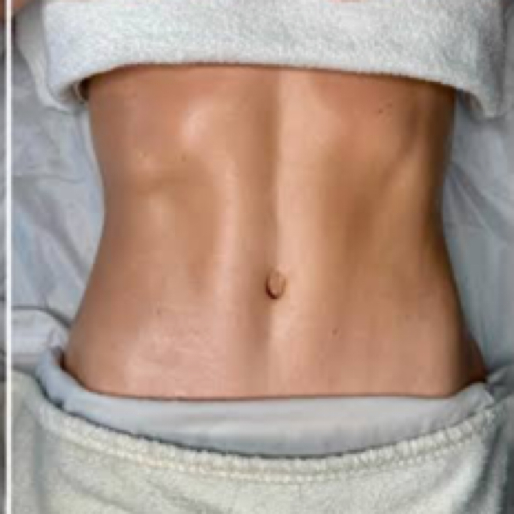 Sculpt And Restore Post Op Massages at Beauty And Body in San Dimas, CA