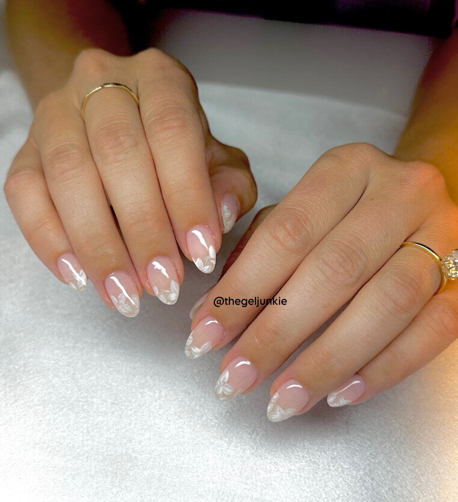 ibd structure gel set