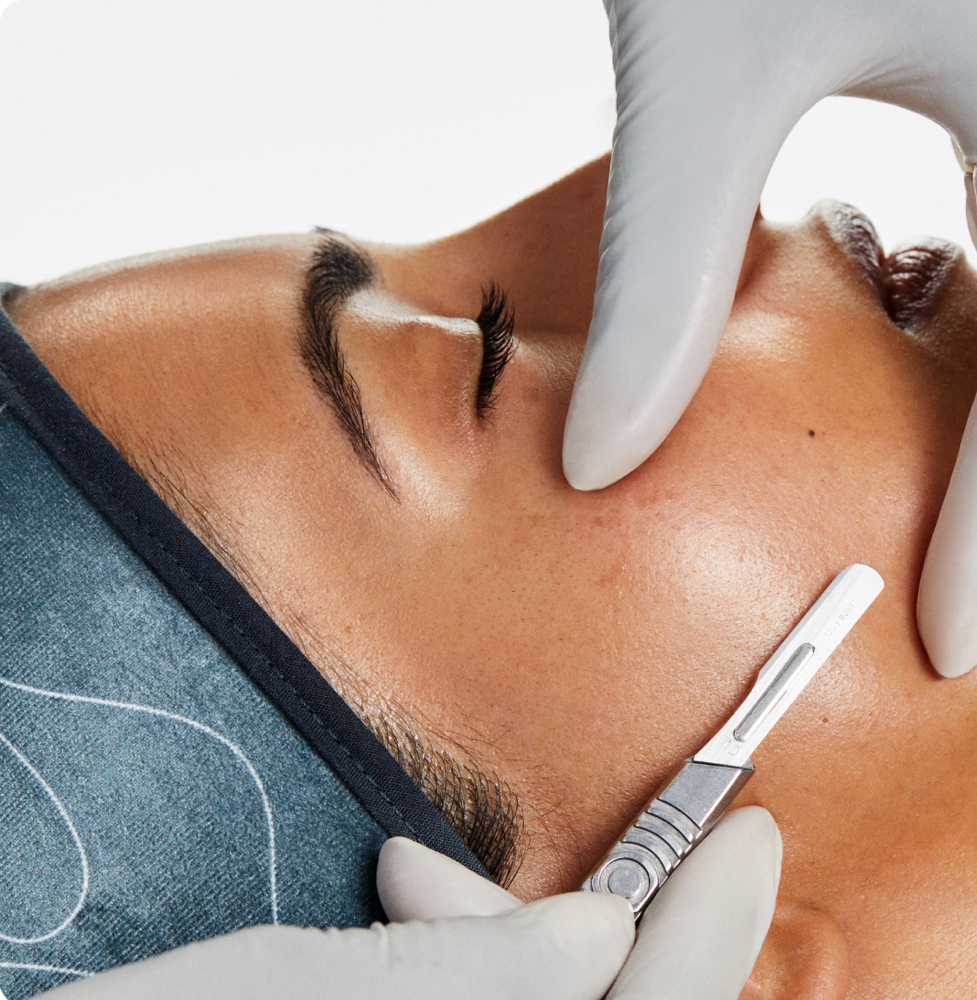 Dermaplaning Add On