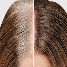 Express Roots