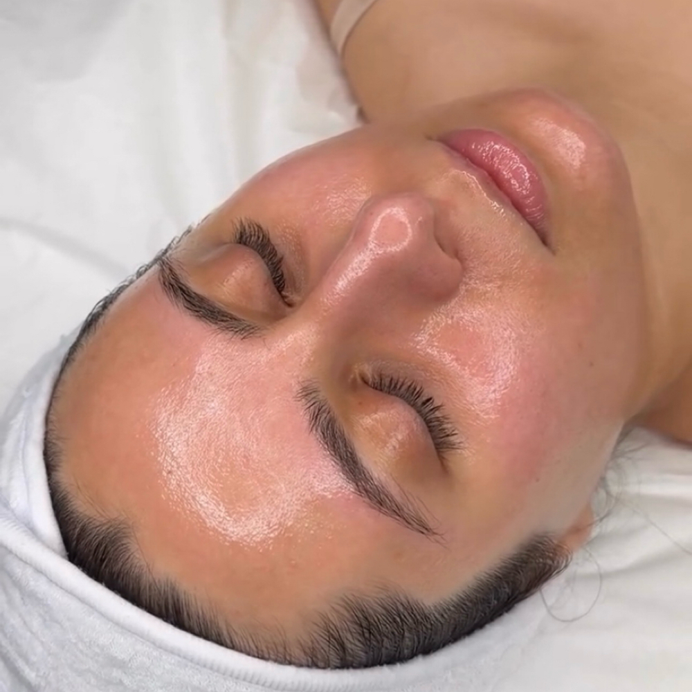 Ultimate Glass Skin Facial at Marta Rabelo Skin & Laser in Malden, MA