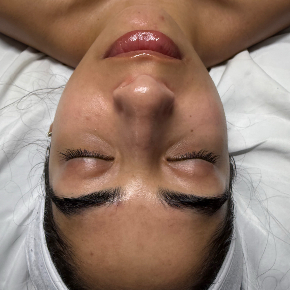 Queen Care Facial at The Glitz Skin Studio in San Antonio, TX
