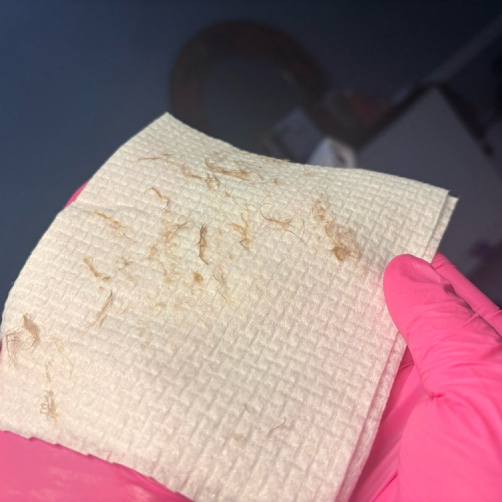 Dermaplane at EstheticsbyMilanea in Rockford, IL