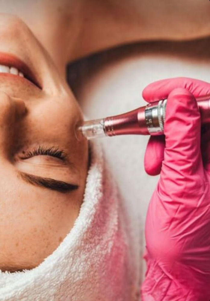 Microneedling at Luxehaus aesthetics & wellness by Cynthia Lucio in Bolingbrook, IL