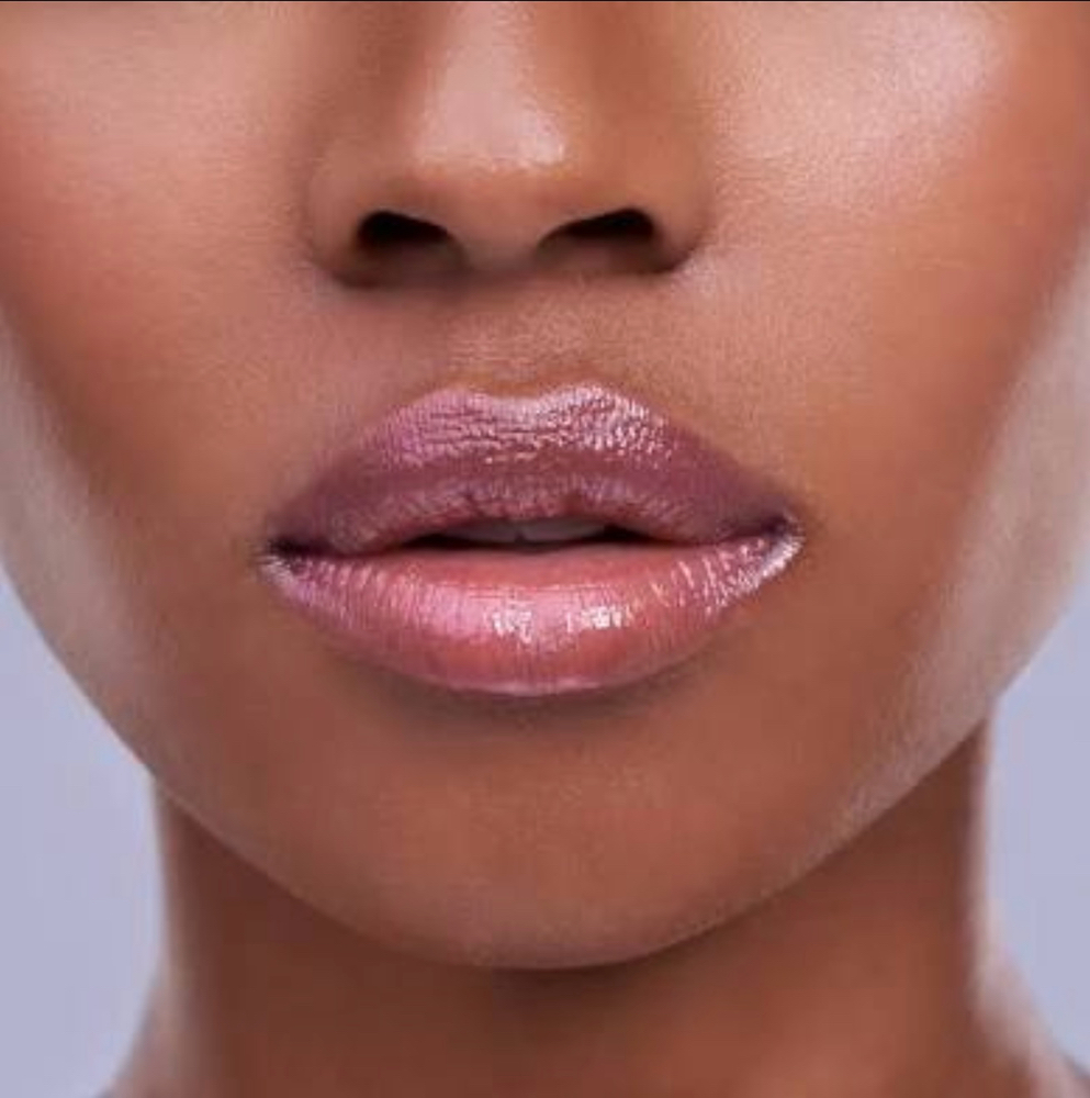 Lip Filler at Valora Aesthetics in Fredericksburg, VA