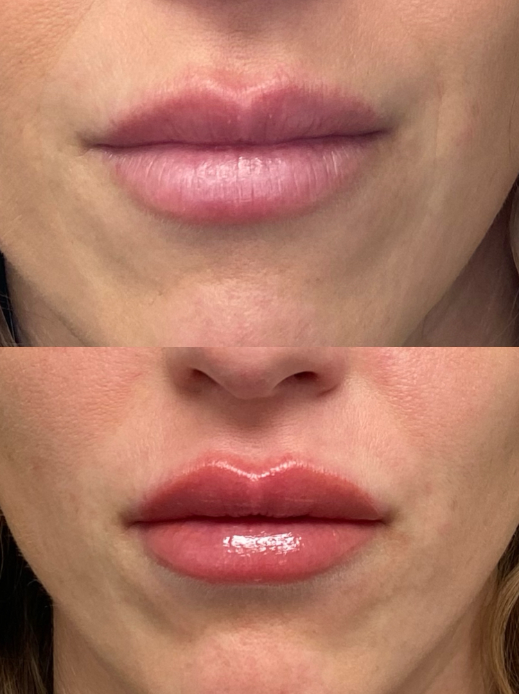 Lip Blush Annual Touch Up