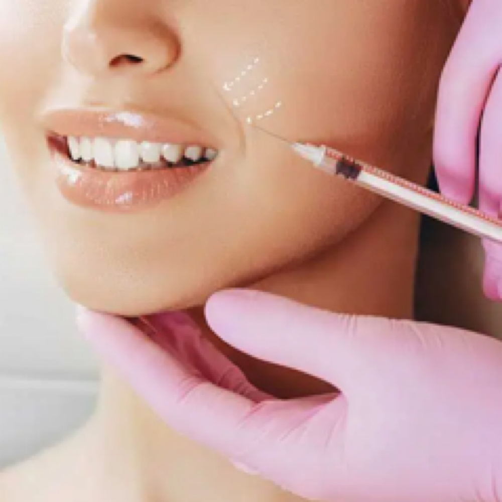 Nasalobial/Marionette Lines Filler at Finesse Sculpt Body Studio in Parkville, MD