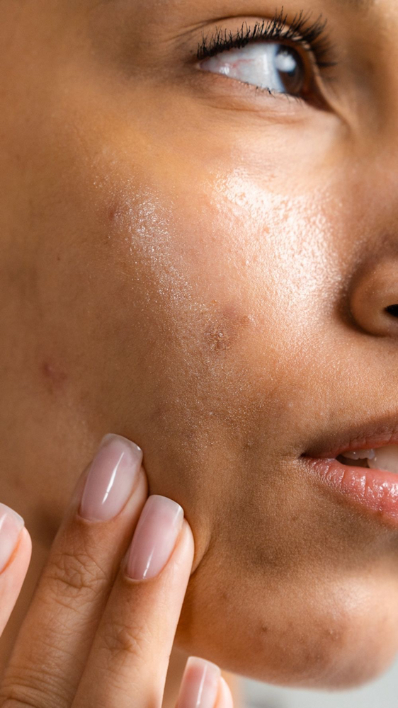 Clarifying Acne Facial