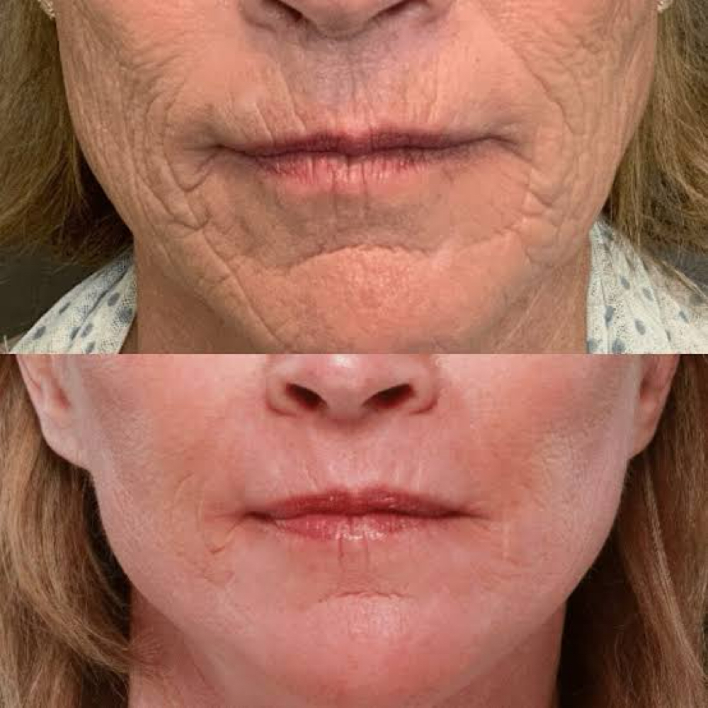Deluxe Anti-Aging at Sculpting Beauty by Pam LLC in Atascocita, TX