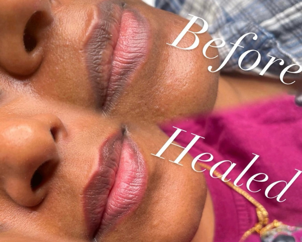 Lip Neutralizing