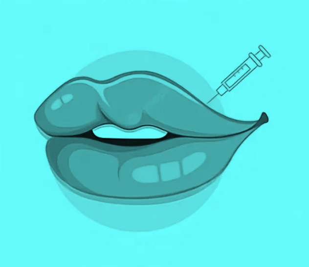 Injectable Filler at Expressions by Dawn - The Beauty Bar in St Louis, MO