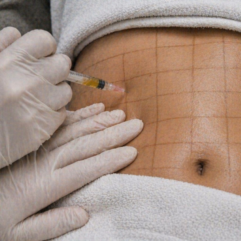 Upper Abdomen Liquid Lipo at Rein Aesthetics & Wellness in Alice, TX