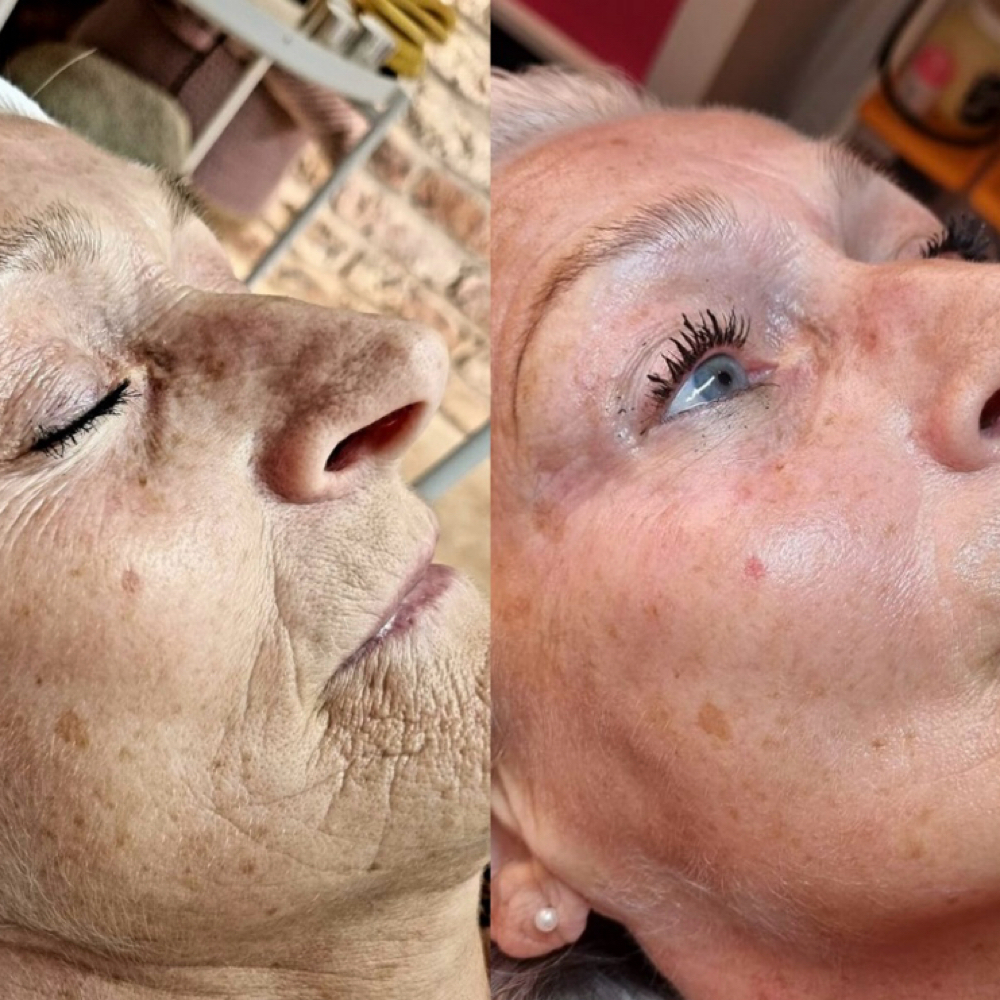 HYDROGLOW FACIAL at Lumiére Skin Science in Atlanta, GA