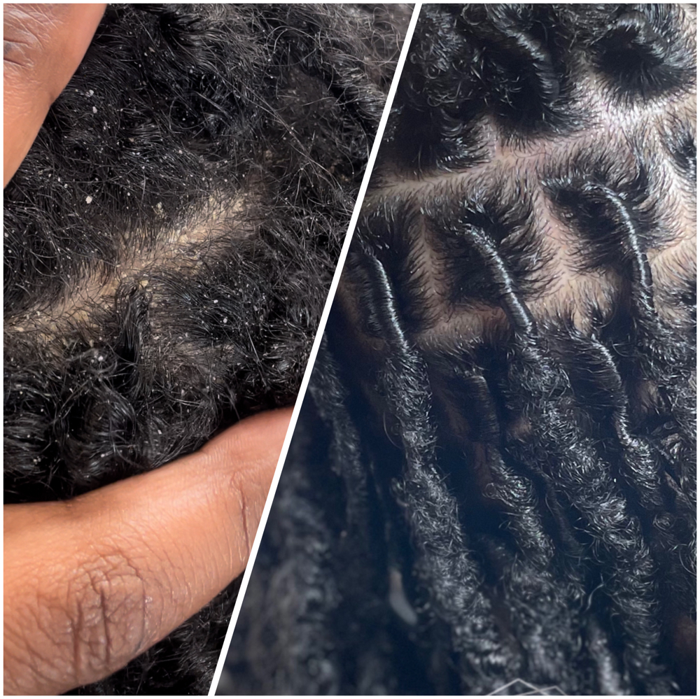 Scalp Rejuvination