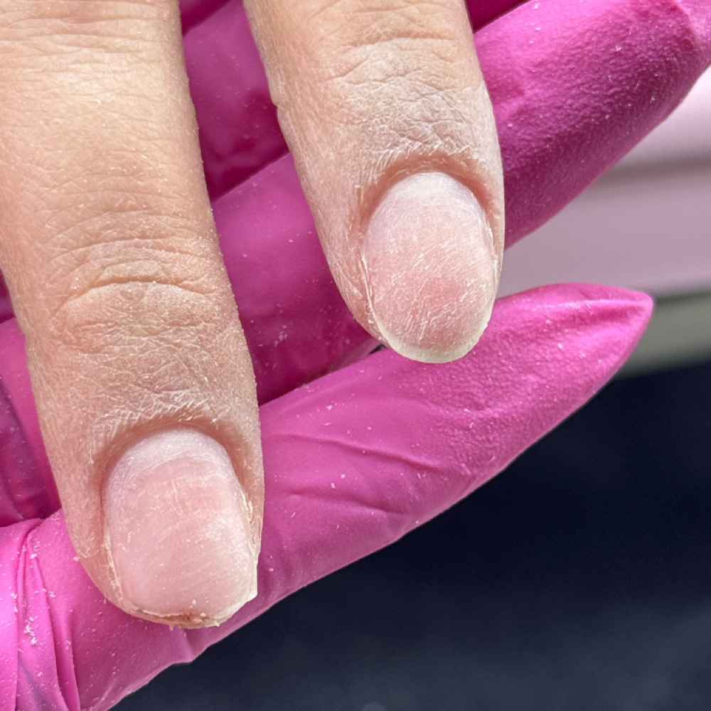 Nail Repair at Haidyn Micah & Co. in Fort Wayne, IN