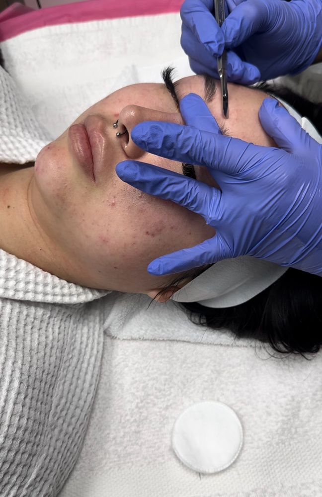 Dermaplan facial