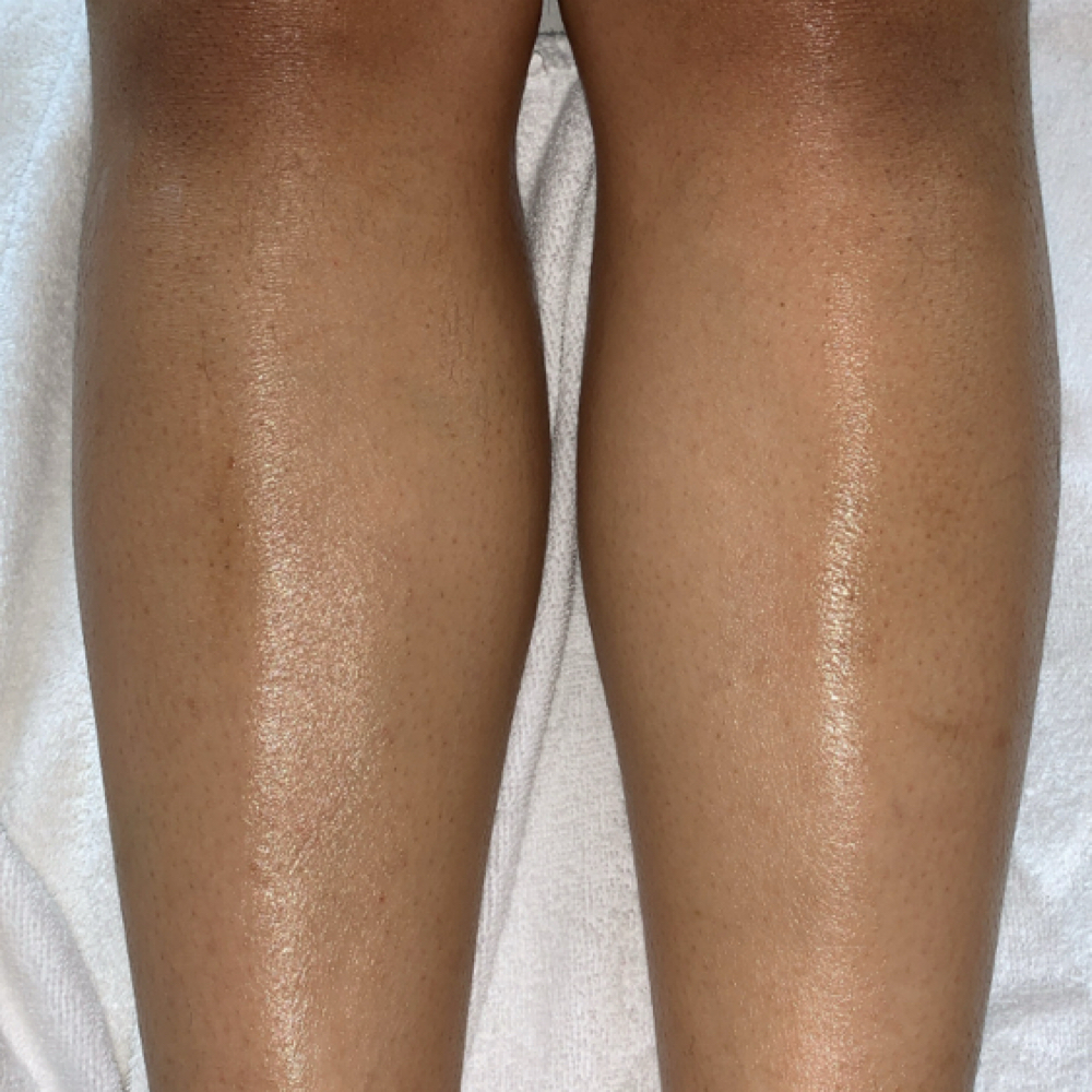 Full Leg Wax at TheSkinOasis Beauty Bar in Conyers, GA
