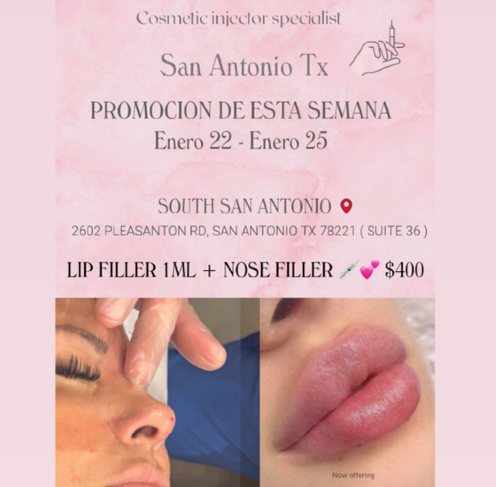 PROMOTION (Lip Filler + Nose Filler at SWEET BODY in San Antonio, TX