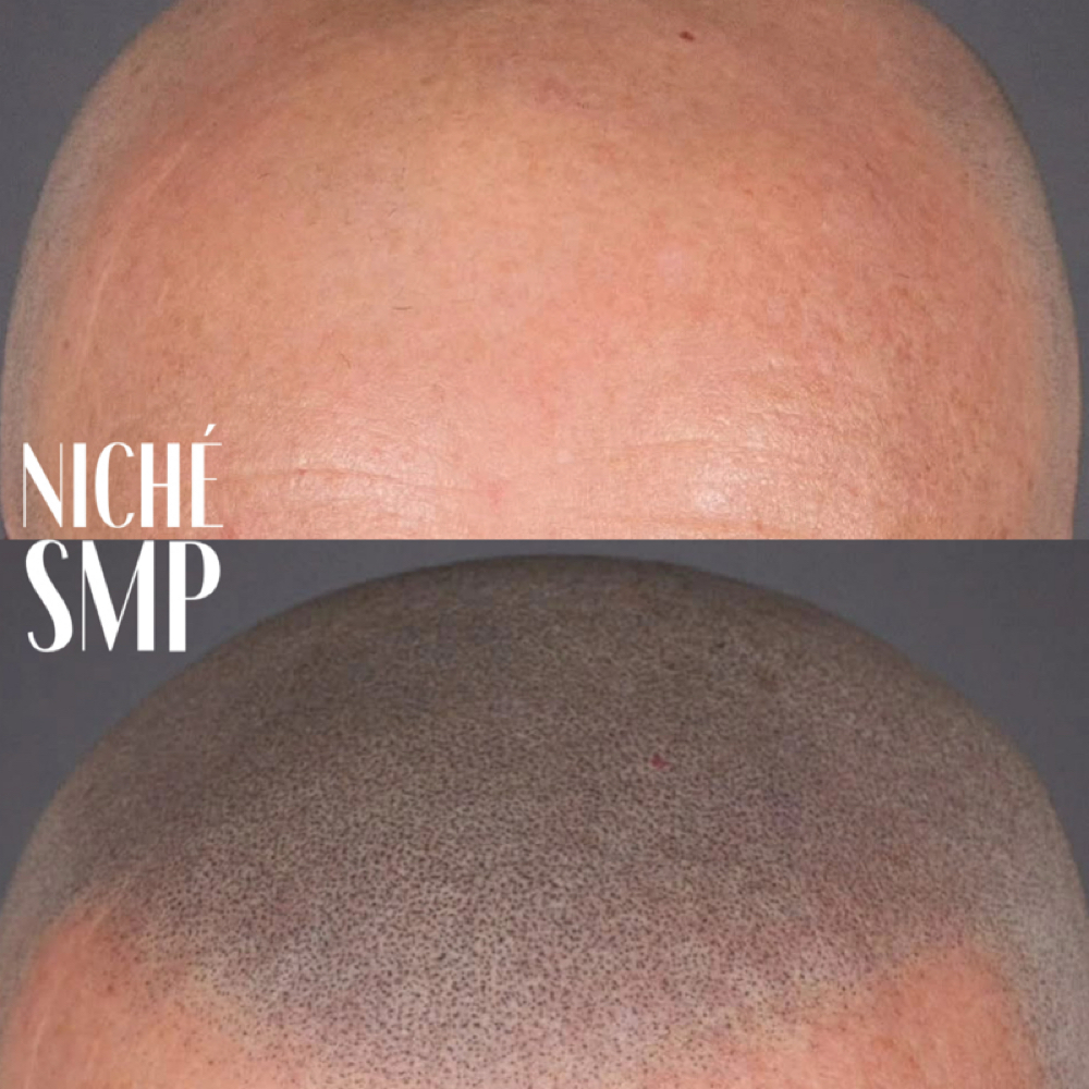 SCALP MICRO PIGMENTATION TRAINING at NICHÉ in Lewisville, TX