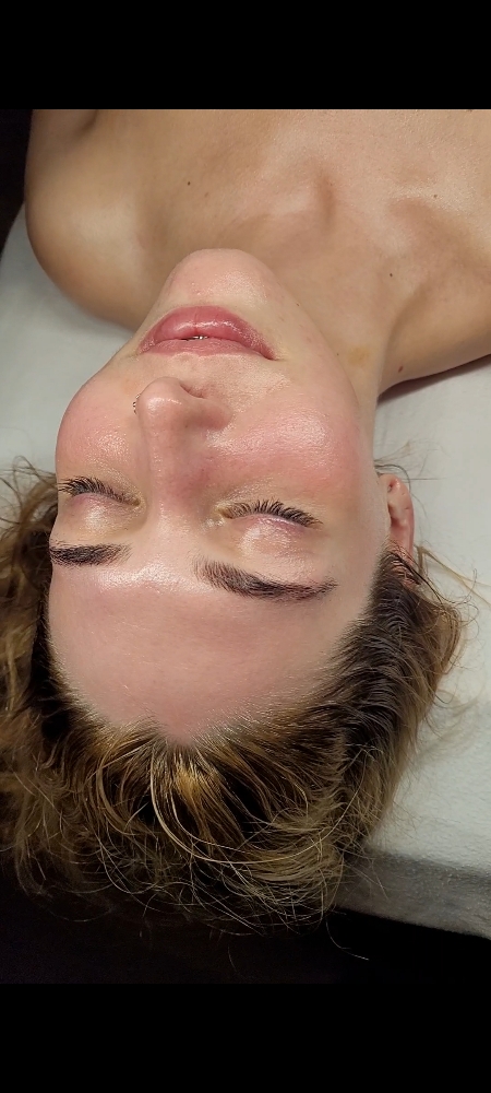 Summer Facial Special