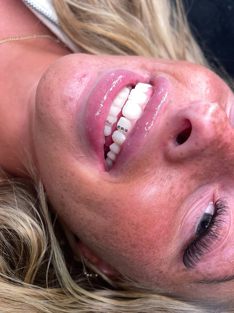 Tooth Gems