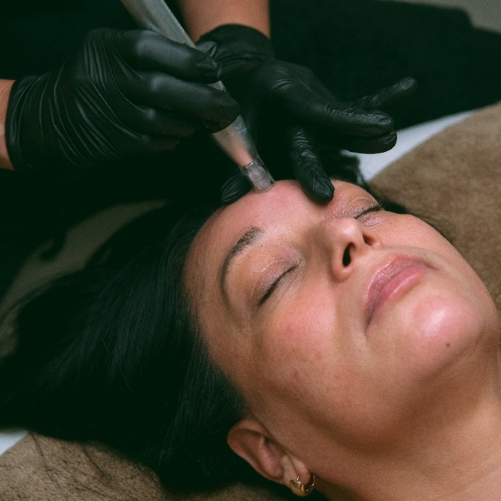 ADD ON "NANO-INFUSION" at 333 Aesthetics in PEORIA, AZ