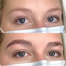 Brow Lamination