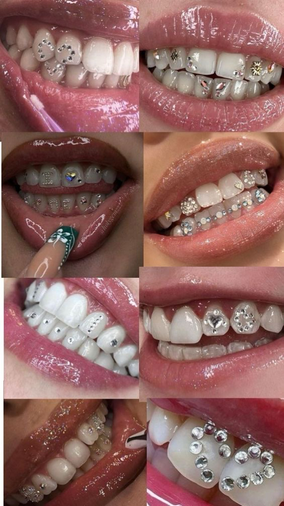 Tooth Gem at BarebyRhea in Rome, GA