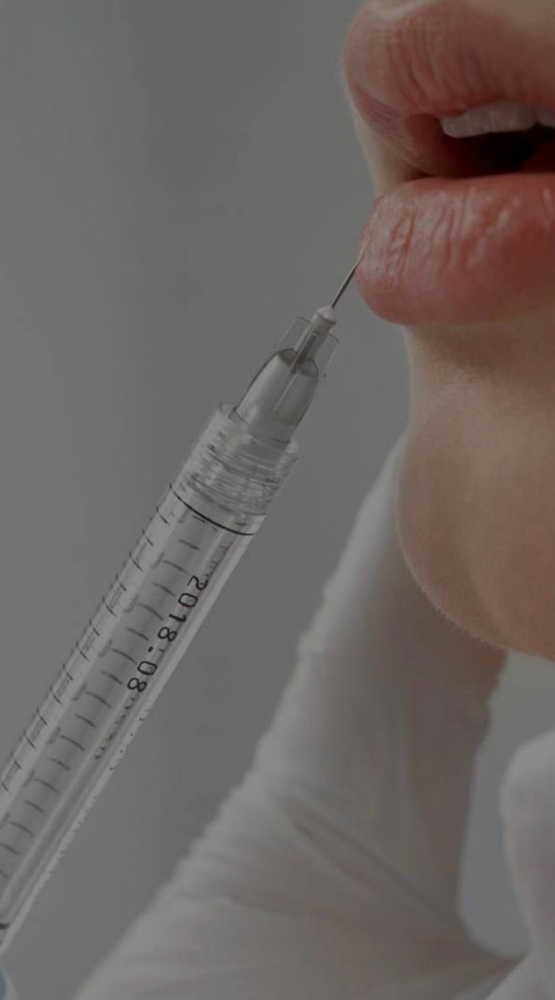Lip Filler - Coming Soon