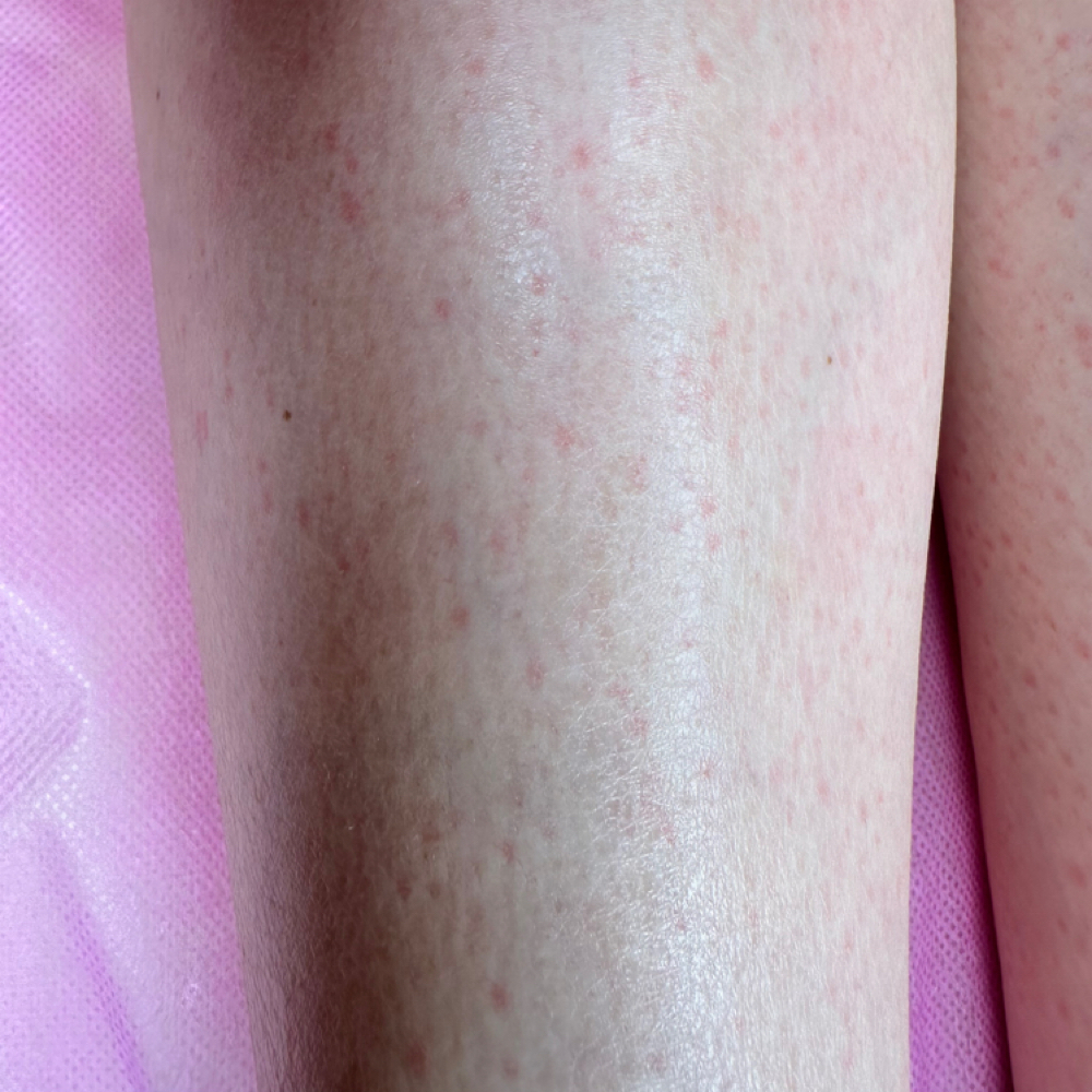 Lower Half Legs Wax at Intimate Wax Studio in Cincinnati, OH