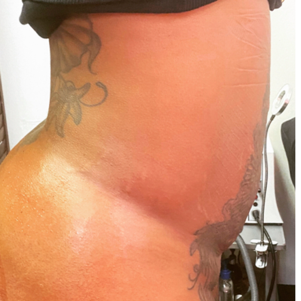 Lymphatic Drainage - 30 Min at 210 The Body Bar | San Antonio Lux Spray Tans & Body Sculpting in San Antonio, TX