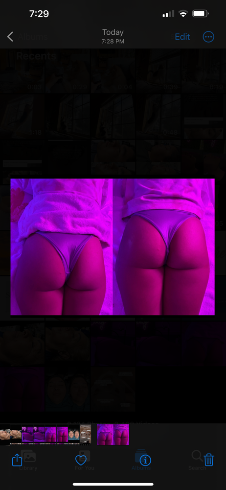 brazilian butt lift