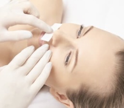 Upper Lip Hair Removal