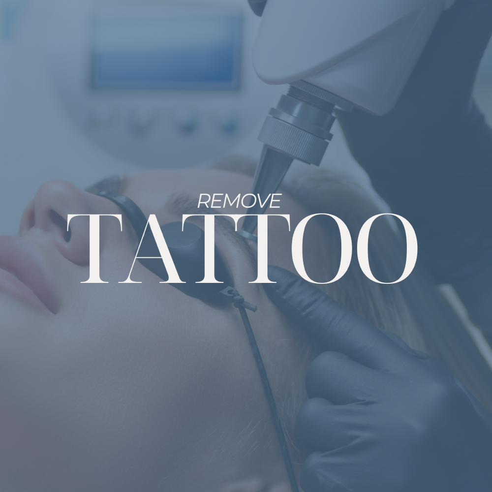 REMOVE TATTOO