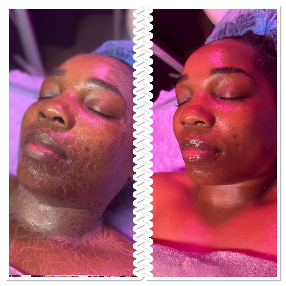 Circadia Luxe Lift AKA Zombie Facia at Shay’s Peaceful Escape, LLC in San Antonio, TX