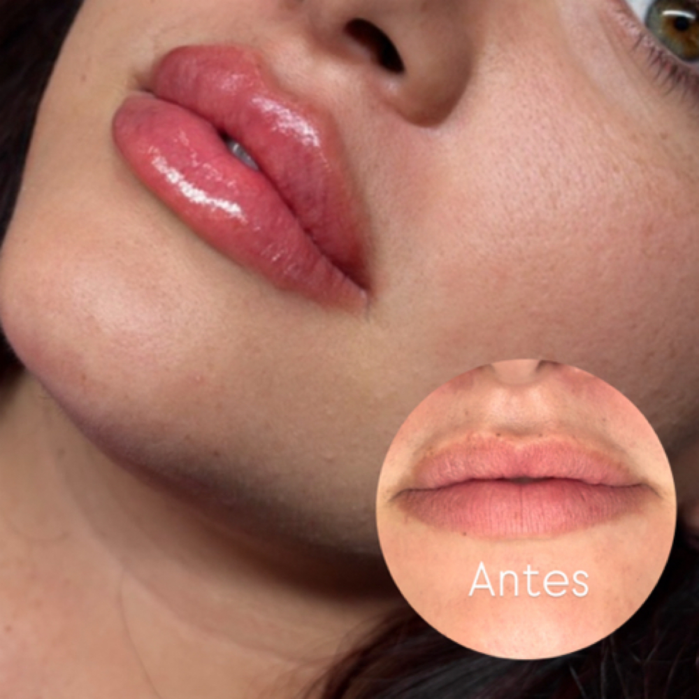 Arreglo De Labios at Sashy Beauty Studio in Carolina, PR