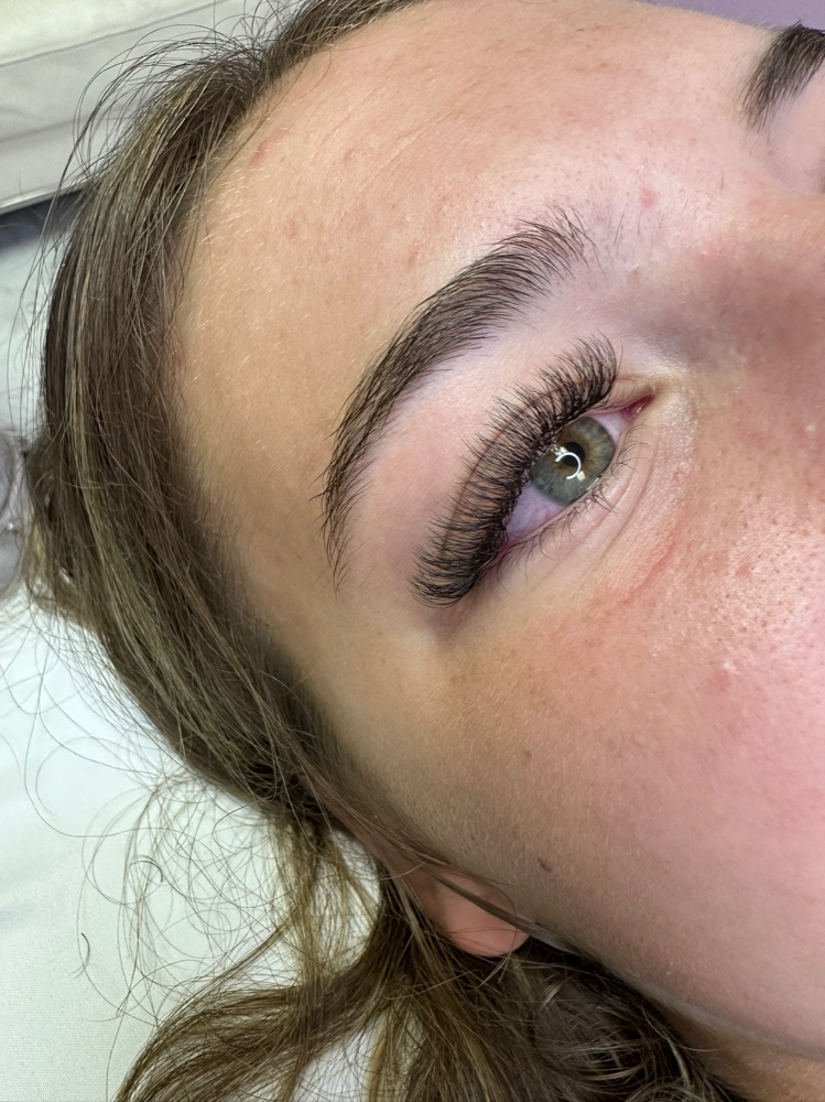 Mini Fill