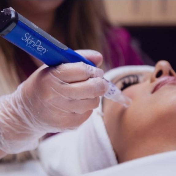 Collagen Induction Therapy at The Beauty ER in Webster, MA