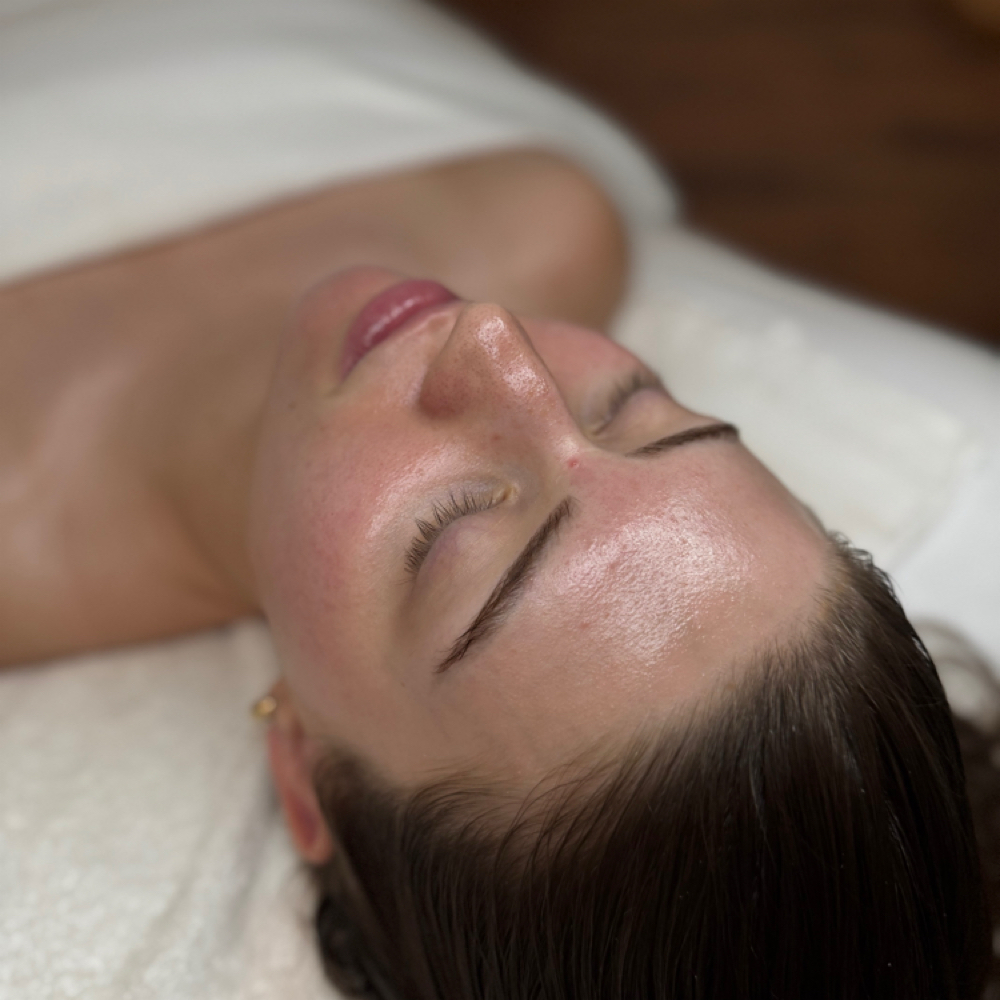 Chemical Peel at Elevate Esthetics in Mesa, AZ