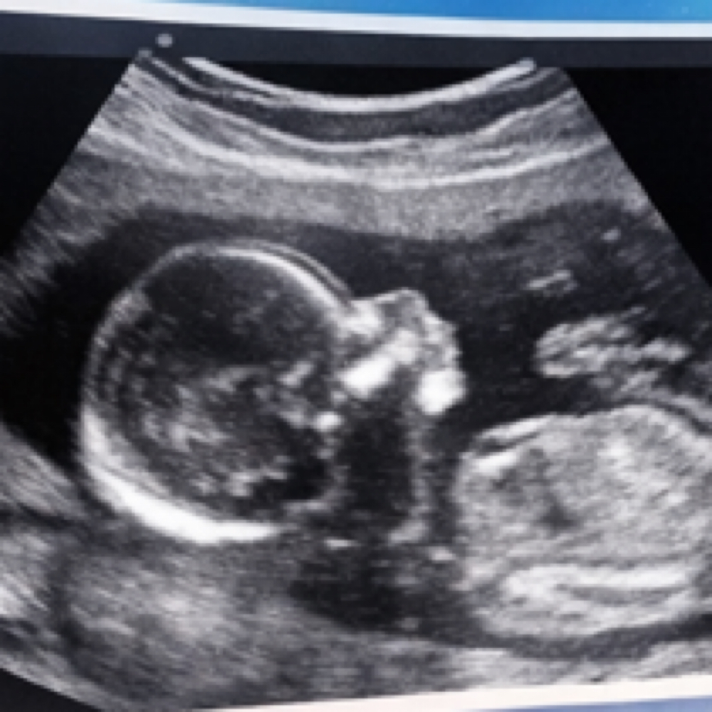Show me my baby! at Babyview 3D4D Imaging in Palmdale, CA