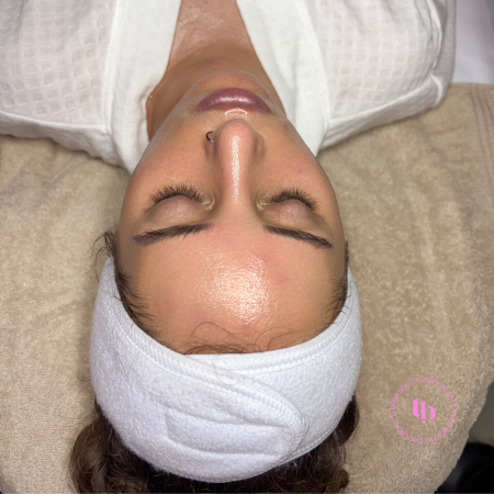 THE SKIN RESET PEEL EXPERIENCE