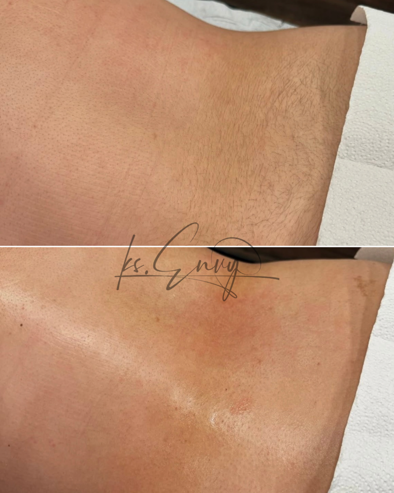 Back (Lower) at KS.Envy in Columbus, OH