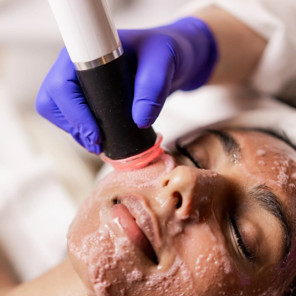 OxyGeneo Facial at Colorado Beauty Bar in Aurora Colorado, CO