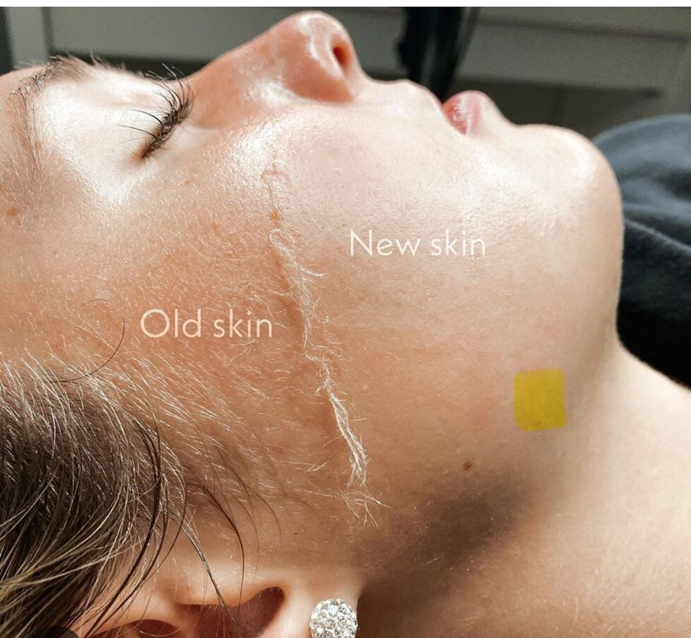 Basic Dermaplane Facial