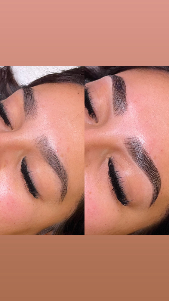 Brow Lift & Shape