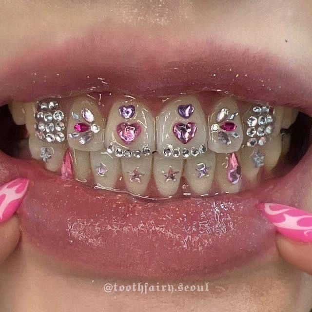 Teeth Gems
