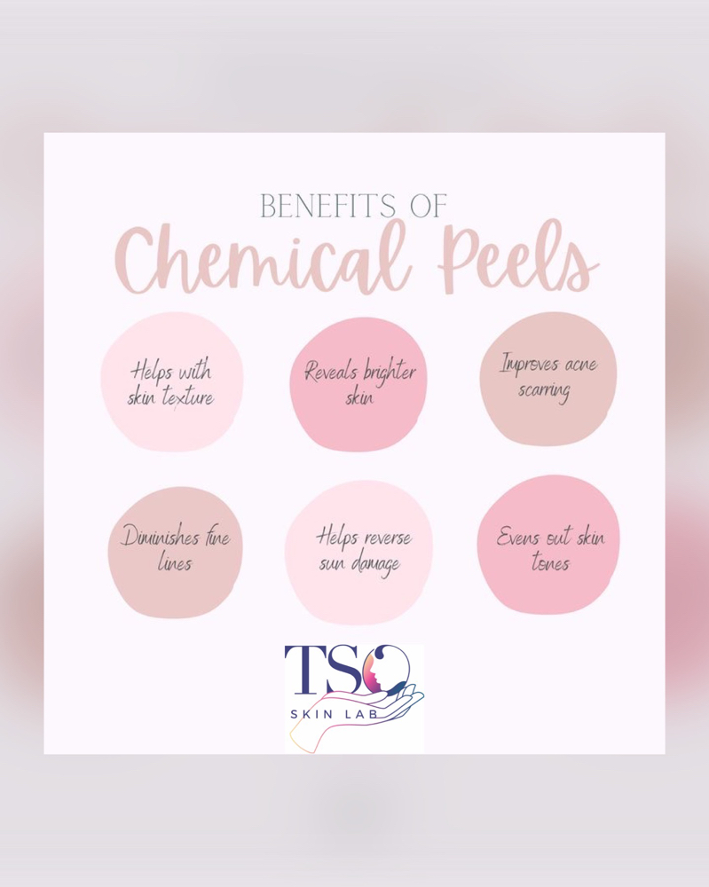 Add On Light Chemical Peel